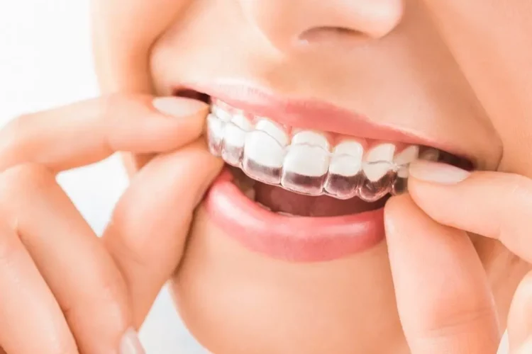 Kieferorthopädie Ü18